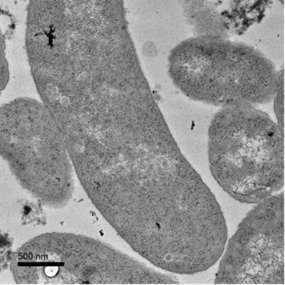 Photo of rod-shaped Bilophila wadsworthia bacterium. Taken by Mike Paxhia.