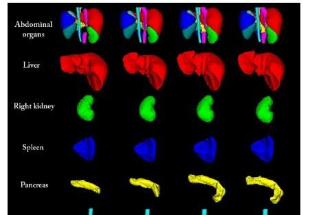 Image from article in Radiology: Artificial Intelligence