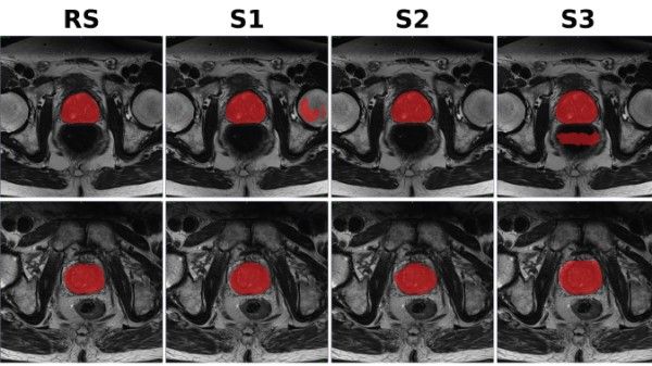 Image from article in Radiology: Artificial Intelligence