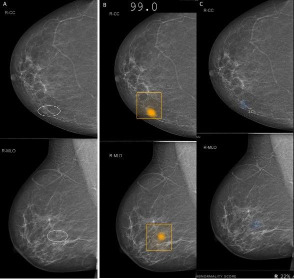 Image from article in Radiology: Artificial Intelligence