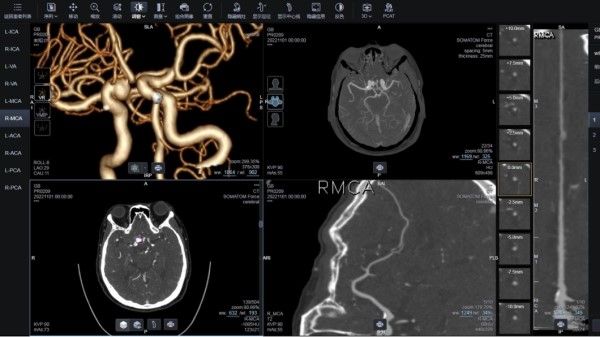 Image from article in Radiology: Artificial Intelligence