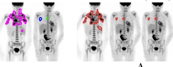Image from article in Radiology: Artificial Intelligence