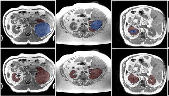 Image from article in Radiology: Artificial Intelligence
