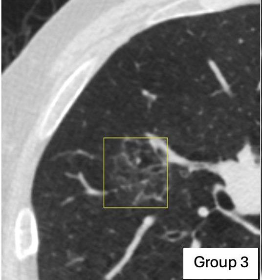 Image from article in Radiology: Artificial Intelligence