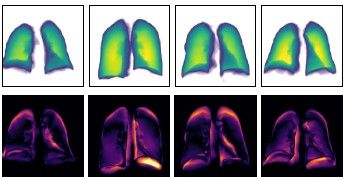 Image from article in Radiology: Artificial Intelligence