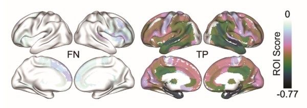 Image from article in Radiology: Artificial Intelligence