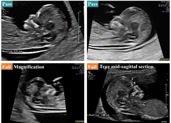 Image from article in Radiology: Artificial Intelligence