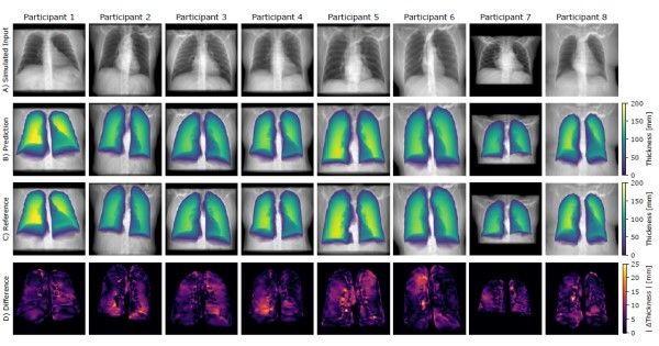 Image from article in Radiology: Artificial Intelligence
