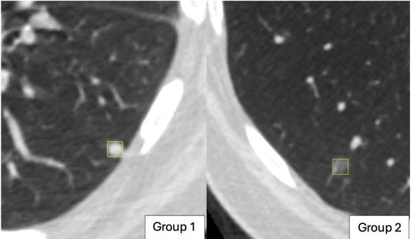 Image from article in Radiology: Artificial Intelligence