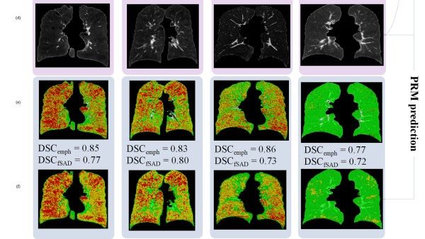 Image from article in Radiology: Artificial Intelligence