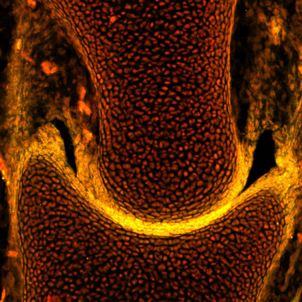 Immunostaining reveals aggrecan (yellow) at the articular surfaces in the pelvic joint of an embryonic little skate (stage 33). The nucleus is stained using DAPI and is shown in red. Credit: Neelima Sharma.