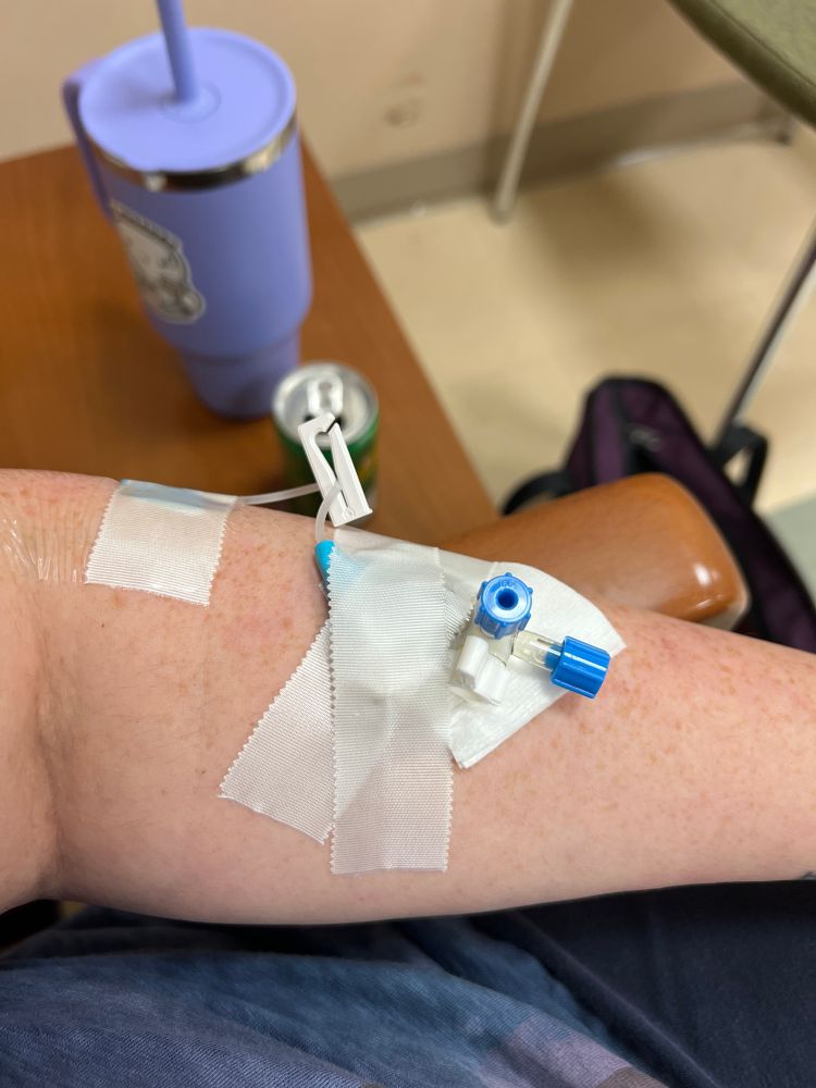 Left forearm with IV taped to arm. 