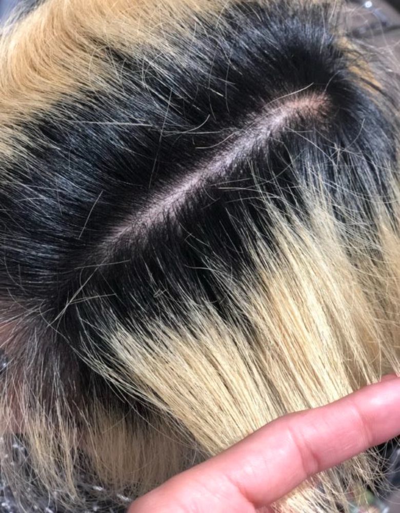 Gros plan sur une teinture blonde dépassée. On voit des racines noires et des cheveux blonds faisant pense à la couleur du flan