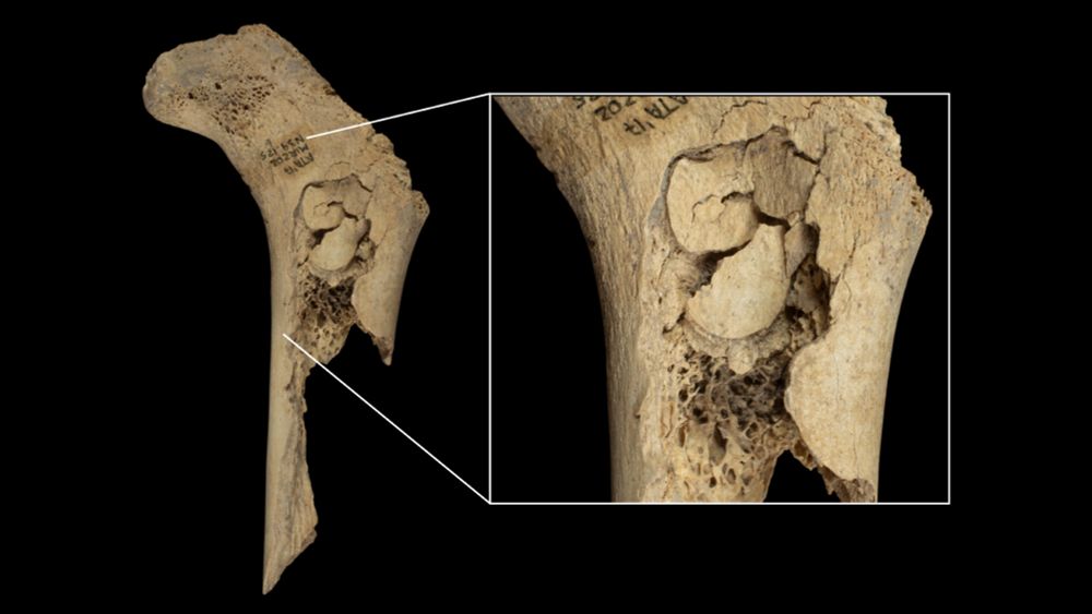 Stone Age family may have been cannibalized for 'ultimate elimination' 5,600 years ago, study suggests