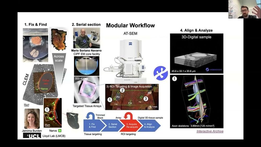 Luke Noon: Thinking outside the (brain) box - vEM Workflows in Liver