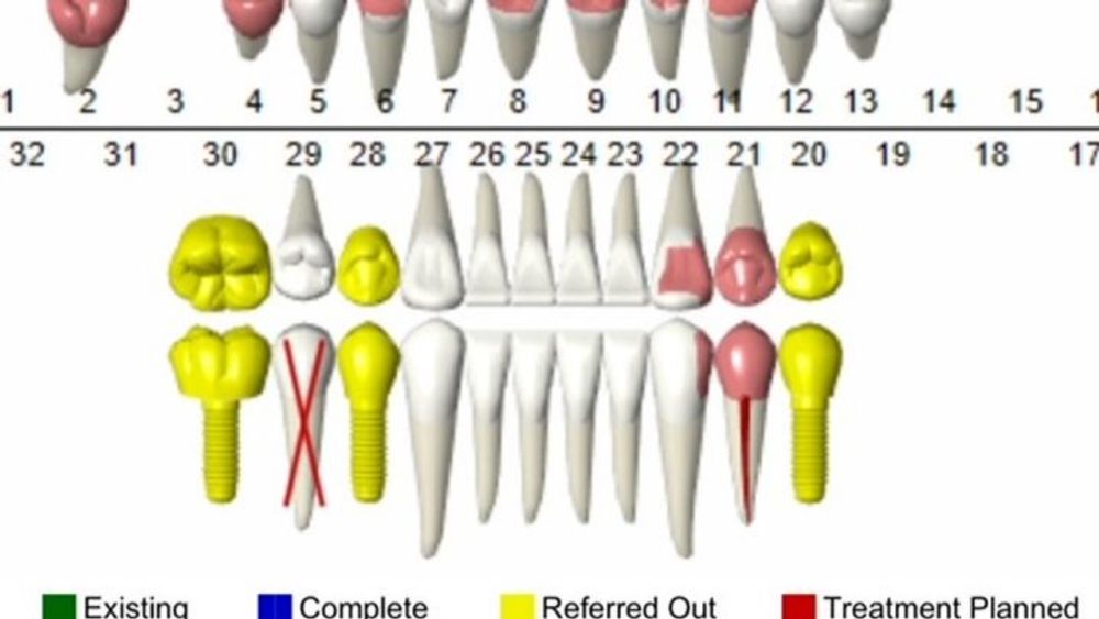 Teeth Are Expensive, organized by Casey Gilly