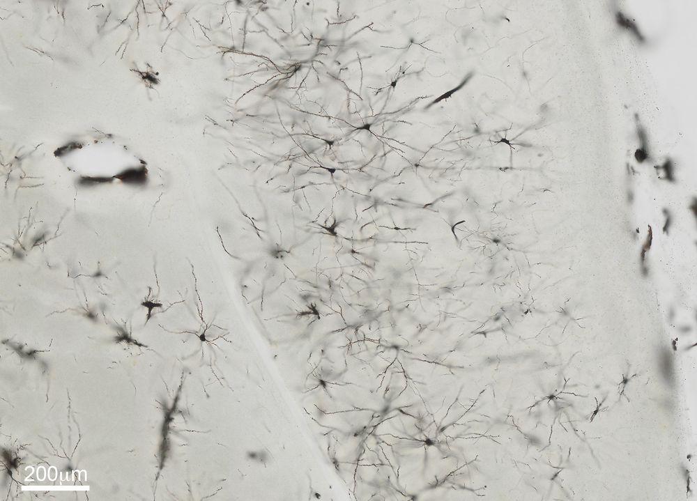 A brain section showing neurons stained black. Their cell bodies and projections are visible.