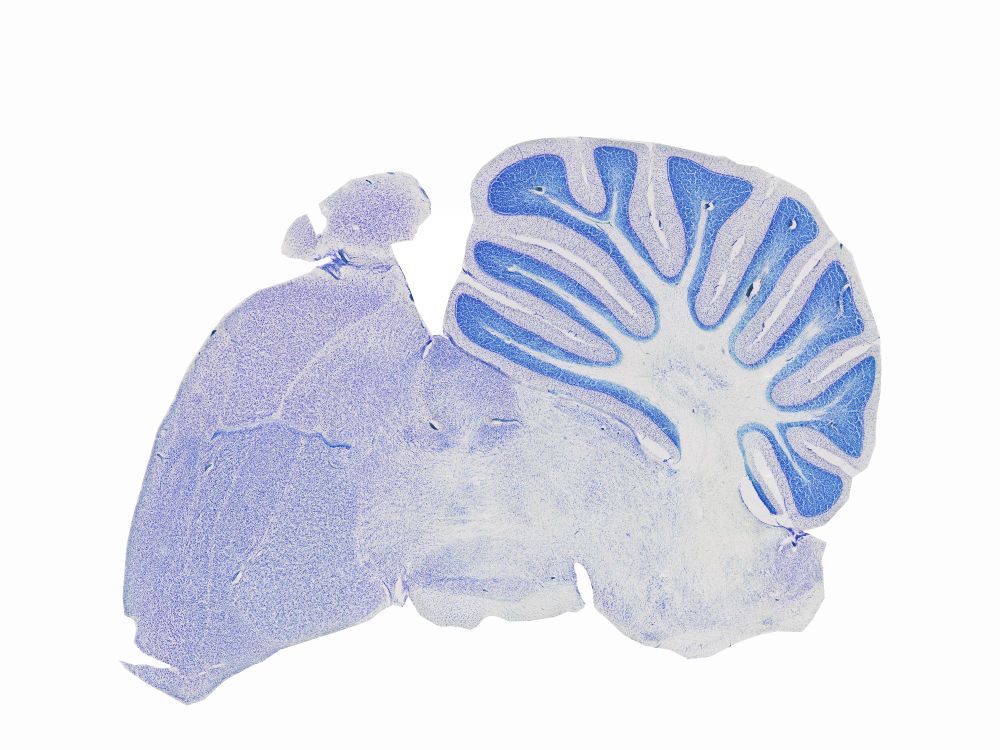 A purple-stained section through the brain of a hummingbird.