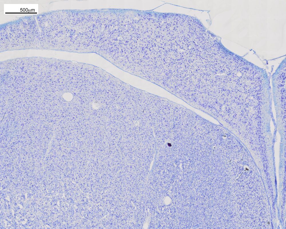 A purple-pink stained section through a pigeon brain. The cell nuclei are stained purple-pink and vary in density across the tissue.