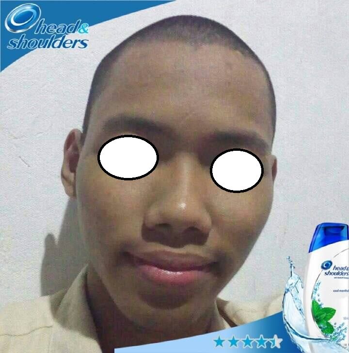 Me, with my eyes put on white oblongs. Also with not much hair on my head.