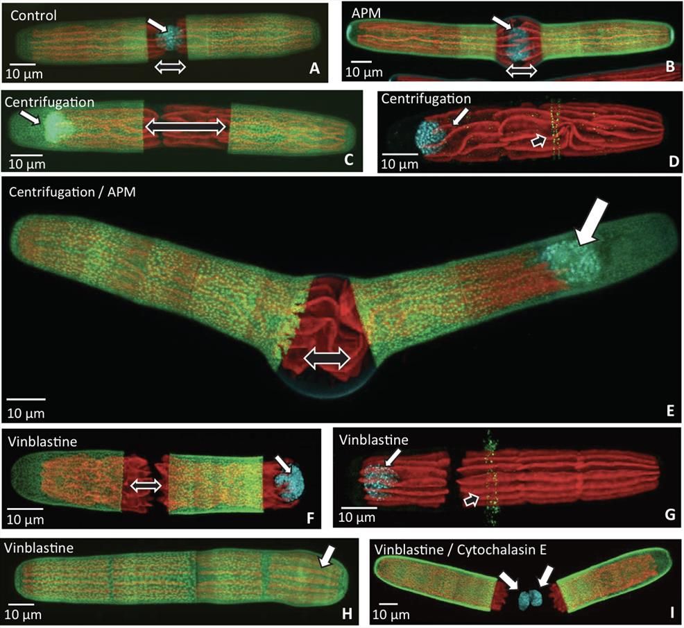 The nucleus and cell wall expansion.