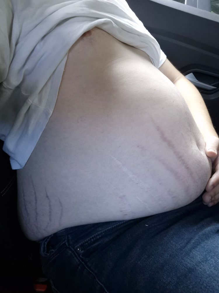 Side view of my post-stuffing gut