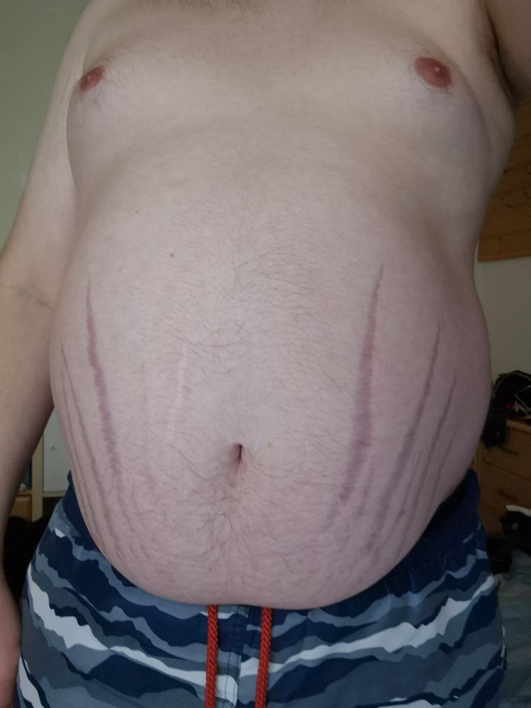 Stuffed gut, front view