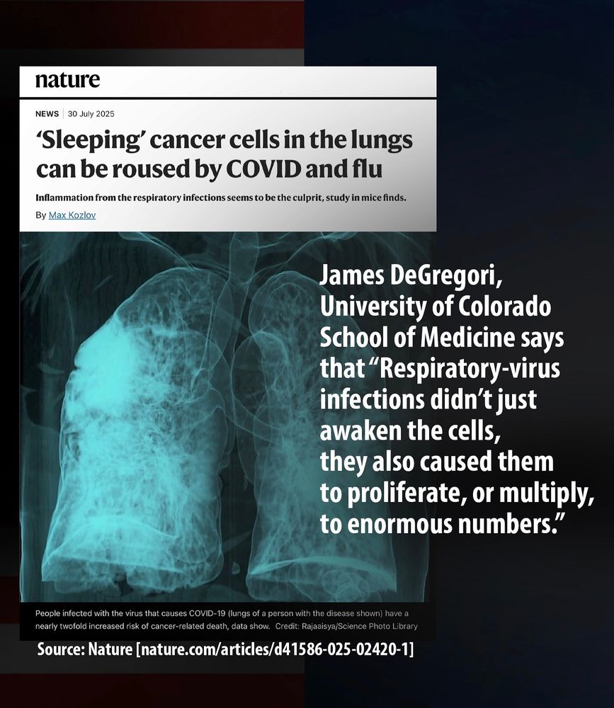Sharing an article in Nature: “Sleeping’ cancer cells in the lungs can be roused by COVlD and flu — Inflammation from the respiratory infections seems to be the culprit, study in mice finds, by Max Kozlov”  Source: https://www.nature.com/articles/d41586-025-02420-1
 
Visual: X-ray of lungs. The caption says: People infected with the virus that causes COVlD-19 (lungs of a person with the disease shown) have a nearly twofold increased risk of cancer-related death, data show. Credit: Rajaaisya/Science Photo Library
 
A quote from the article: James DeGregori, University of Colorado School of Medicine says that “Respiratory-virus infections didn’t just awaken the cells, they also caused them to proliferate, or multiply, to enormous numbers.”