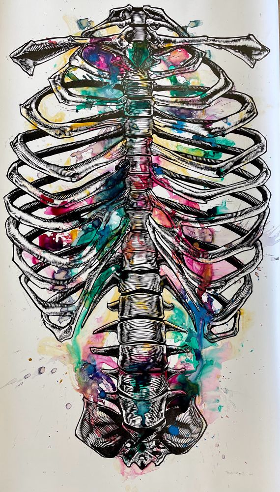 “Trashed: Aches and Pains” linocut with acrylic inks on yupo paper.  