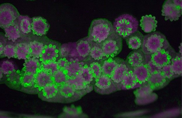 Rice Coral (M. capitata) polyps at one month of age labeled with GFP (green). Autofluorescence of their symbiotic algae (magenta). Captured with an epifluorescence microscope. (Credit: Emma Rangel-Huerta)