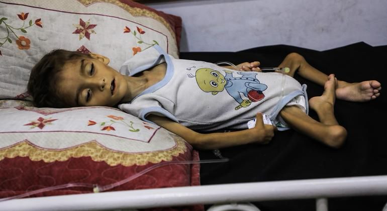 Acute malnutrition among children in Gaza has reached the highest levels to date as hunger continues to deepen in the enclave, the UN Office for the Coordination of Humanitarian Affairs (OCHA) reporte...