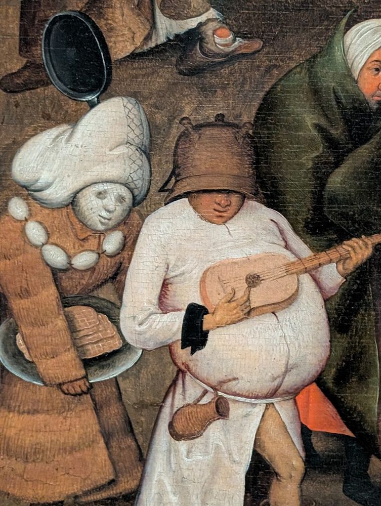 Cette image montre un détail du célèbre tableau "Le Combat entre Carnaval et Carême" de Pieter Bruegel l'Ancien (1559). Au centre, on voit un musicien corpulent en blanc qui joue du luth, incarnant l'esprit festif et gourmand du Carnaval. Il porte une petite marmitte renversée sur la tête, lui cachant les yeux.
À sa gauche se trouve un personnage grotesque également vêtu de blanc, avec une poêle noire renversée sur la tête comme une plume sur un turban ; un chapelet d'œufs lui faisant office de collier. Il s'agit là d'une figure comique typique des réjouissances carnavalesques. Il tient ce qui s'apparente à un plateau de gauffres entre les mains. Ce personnage aux formes exagérées symbolise l'excès et la débauche associés à la période de Carnaval.
À droite, on aperçoit une figure en vert sombre, contrastant avec les personnages clairs du Carnaval. Le sol pavé est jonché d'objets divers - gaufres, ustensiles de cuisine - évoquant les festivités et les excès alimentaires qui précèdent le jeûne du Carême.
Ce détail illustre parfaitement l'opposition centrale du tableau de Bruegel entre les plaisirs charnels du Carnaval et l'austérité spirituelle du Carême, thème allégorique majeur de l'art flamand du 16ème siècle.