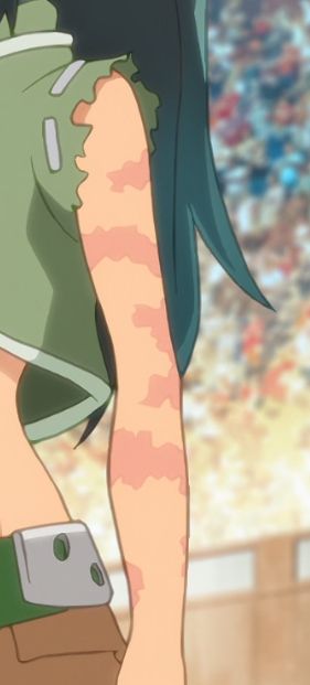 The anime girl's other arm, which is covered in striped scars. 