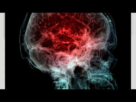 Human Brains are Now 99.5% Human and 0.5% Plastic