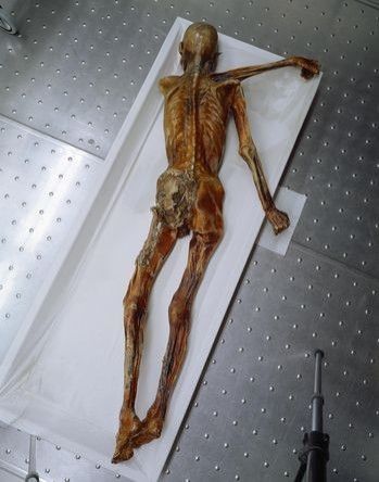 Ötzi the Iceman laying face down on an examination table. his left arm is pinned under his torso and sticking straight out to the right 