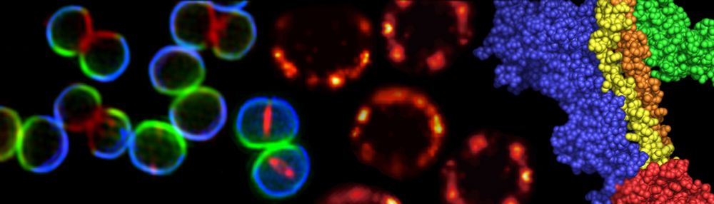 Archaeal and bacterial cell division: Beyond the Z-ring