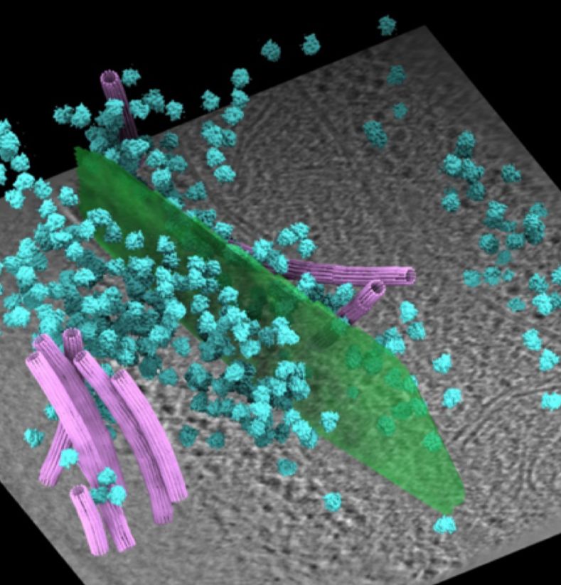 CryoET tomogram with the gap junction (green), ribosomes (cyan) and microtubules (pink)