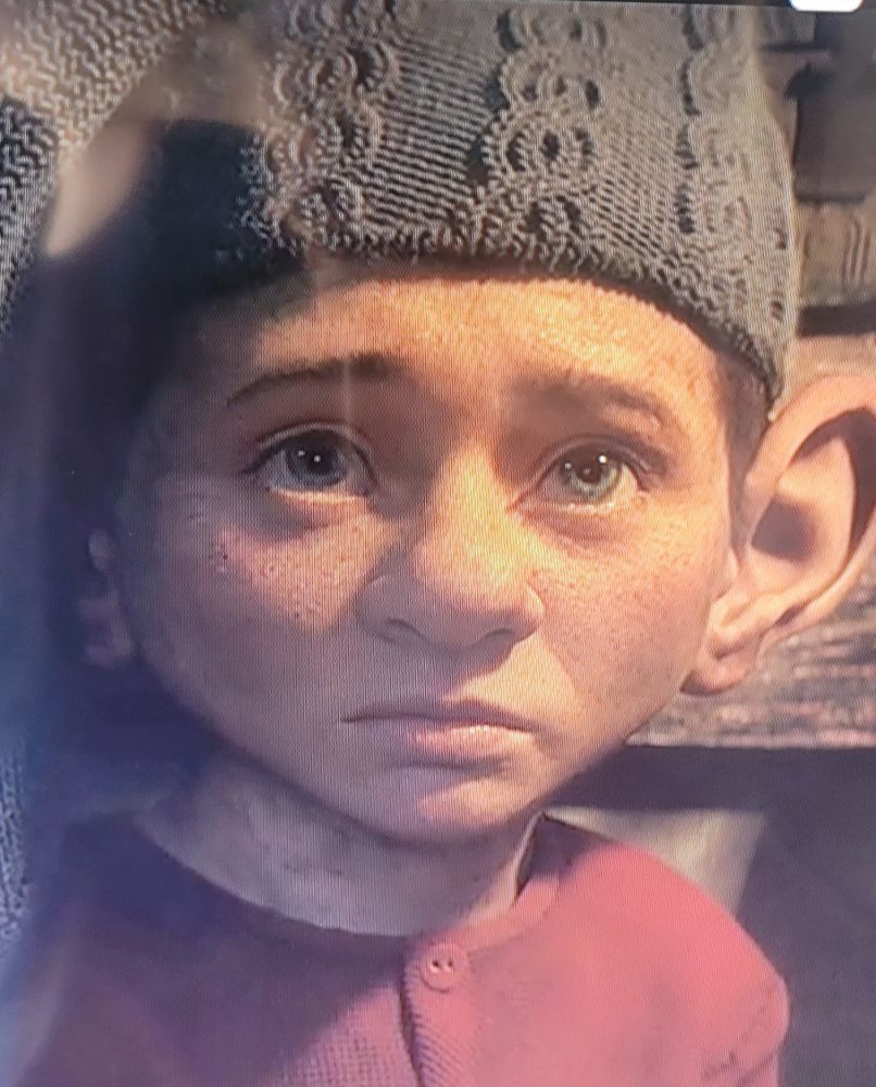 A still of Dopey from the latest iteration of Snow White. Round face; big ears; blue eyes; freckles, auburn hair, profound nose. 