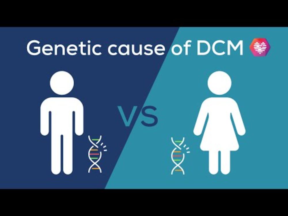 Study Summary: Sex Differences in the Genetic Cause of DCM