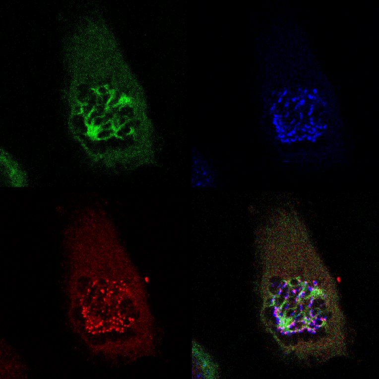 Cell in mitosis analyzed by immunofluorescence. Shows tubulin, centromeres, and Mad2