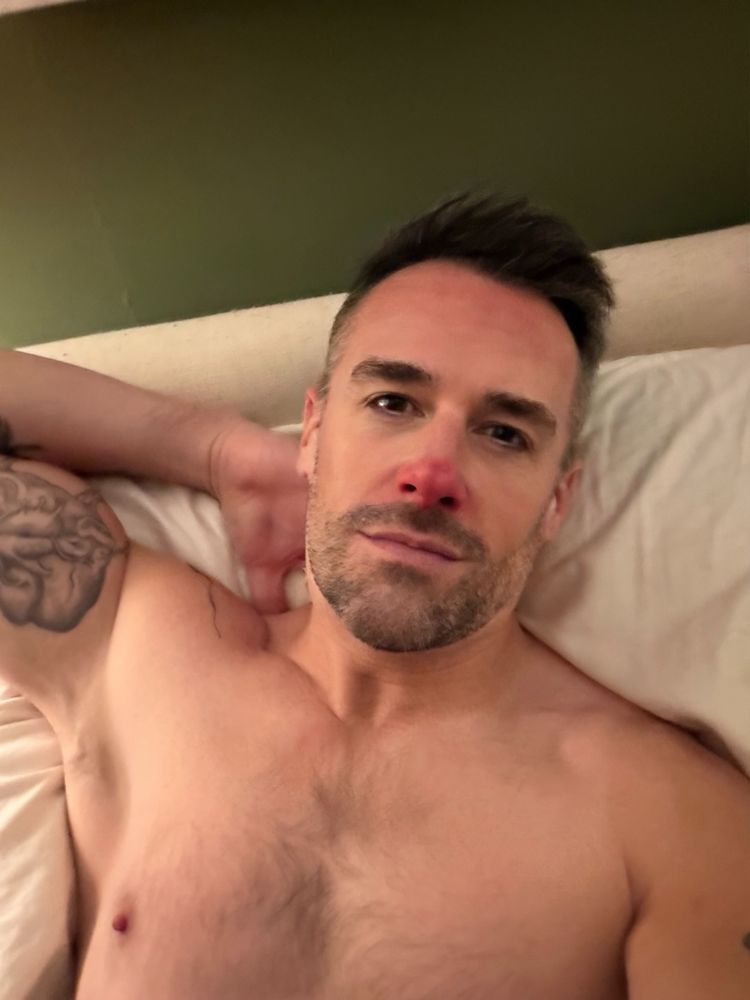 Picture of a mouse that's been shaved bald except for a little in his armpits and chest that remain. 