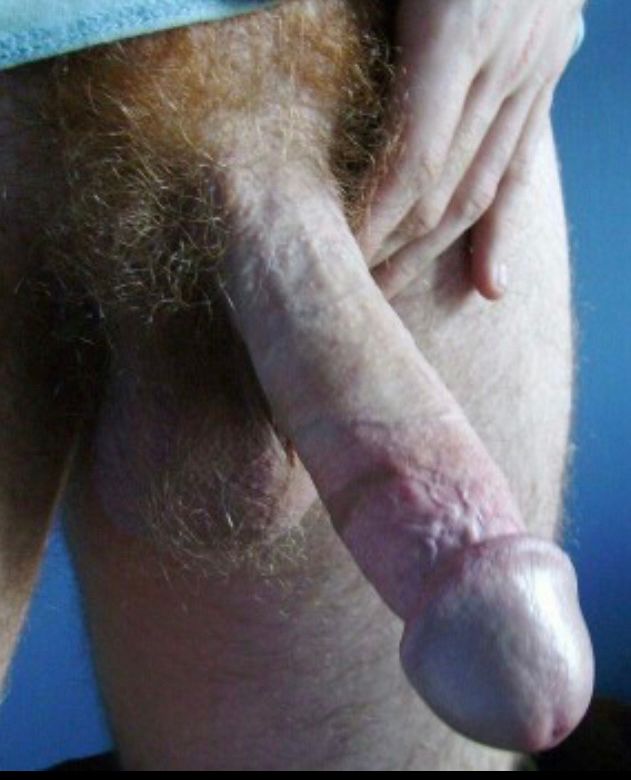 Penis 
