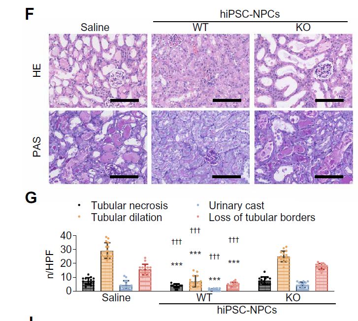 Top: Histology pictures showing effect of unmodified NPCs and VEGF-A deficient NPCs on kidney injury. Bottom: Bar graphs quantifying the effects of saline injection, unmodified NPCs and VEGF-A deficient NPCs on histologic features of kidney injury