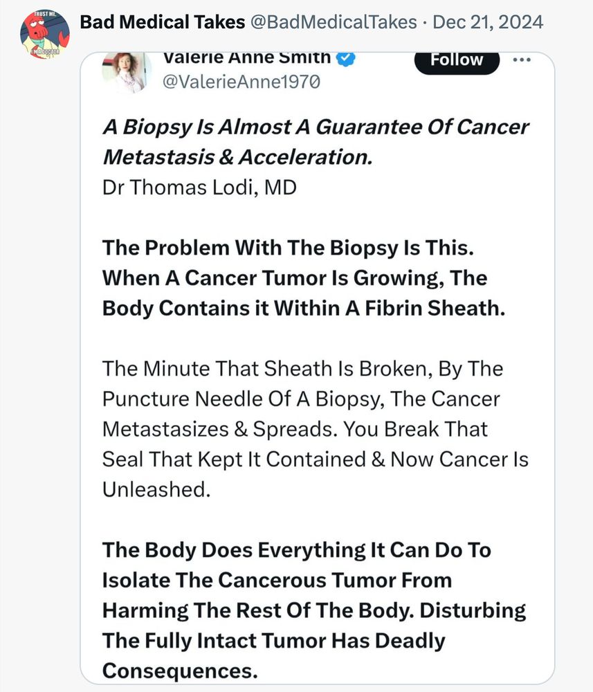 Bad Medical Taker Valerie Anne Smith (@ValerieAnne1970) previously showcased on Bad Medical Takes: A Biopsy Is Almost A Guarantee Of Cancer Metastasis & Acceleration. Dr Thomas Lodi, MD The Problem With The Biopsy Is This. When A Cancer Tumor Is Growing, The Body Contains it Within A Fibrin Sheath. The Minute That Sheath Is Broken, By The Puncture Needle Of A Biopsy, The Cancer Metastasizes & Spreads. You Break That Seal That Kept It Contained & Now Cancer Is Unleashed. The Body Does Everything It Can Do To Isolate The Cancerous Tumor From Harming The Rest Of The Body. Disturbing The Fully Intact Tumor Has Deadly Consequences. 