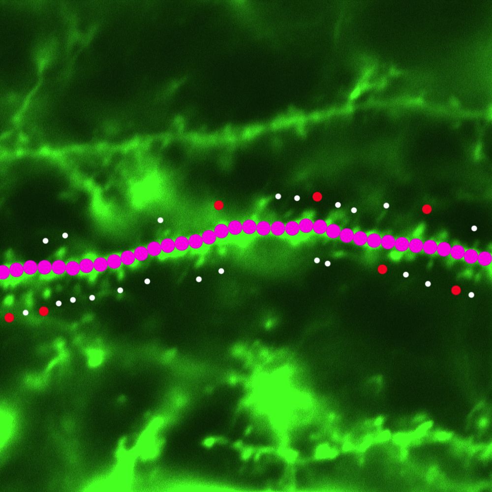 microscope (confocal) image of the memory hub of the brain. we use mice whose neuronal processes are green. we mark the connections between two cells in white or red dots and use a line of pink dots to show distance  