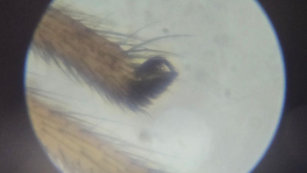 A through-the-eyepiece view of the claw tuft of a resplendent running crab spider, shot on a phone with a kids' toy microscope.