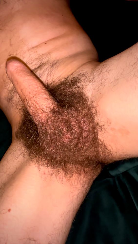 Hairy balls
