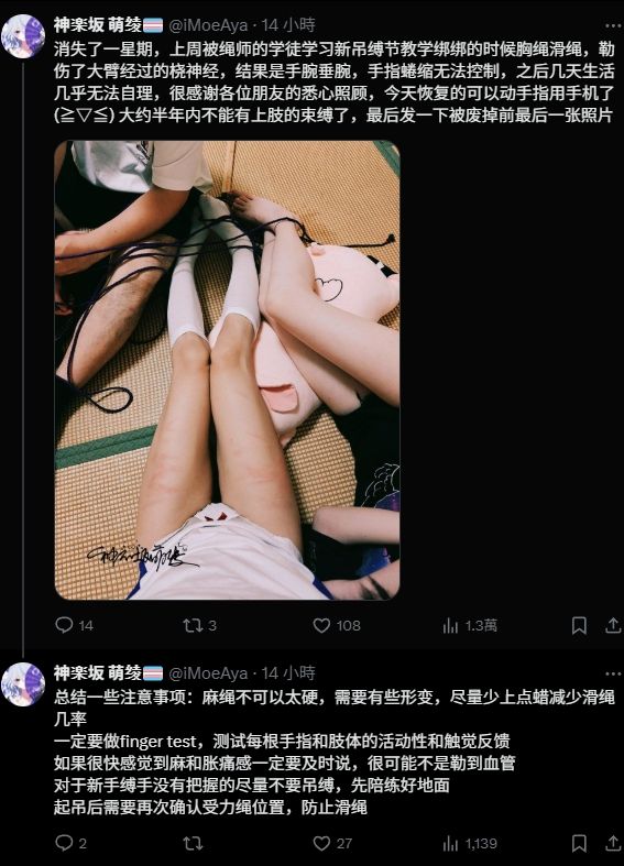 消失了一星期，上周被绳师的学徒学习新吊缚节教学绑绑的时候胸绳滑绳，勒伤了大臂经过的桡神经，结果是手腕垂腕，手指蜷缩无法控制，之后几天生活几乎无法自理，很感谢各位朋友的悉心照顾，今天恢复的可以动手指用手机了(≧▽≦) 大约半年内不能有上肢的束缚了，最后发一下被废掉前最后一张照片。
总结一些注意事项：麻绳不可以太硬，需要有些形变，尽量少上点蜡减少滑绳几率
一定要做finger test，测试每根手指和肢体的活动性和触觉反馈
如果很快感觉到麻和胀痛感一定要及时说，很可能不是勒到血管
对于新手缚手没有把握的尽量不要吊缚，先陪练好地面
起吊后需要再次确认受力绳位置，防止滑绳