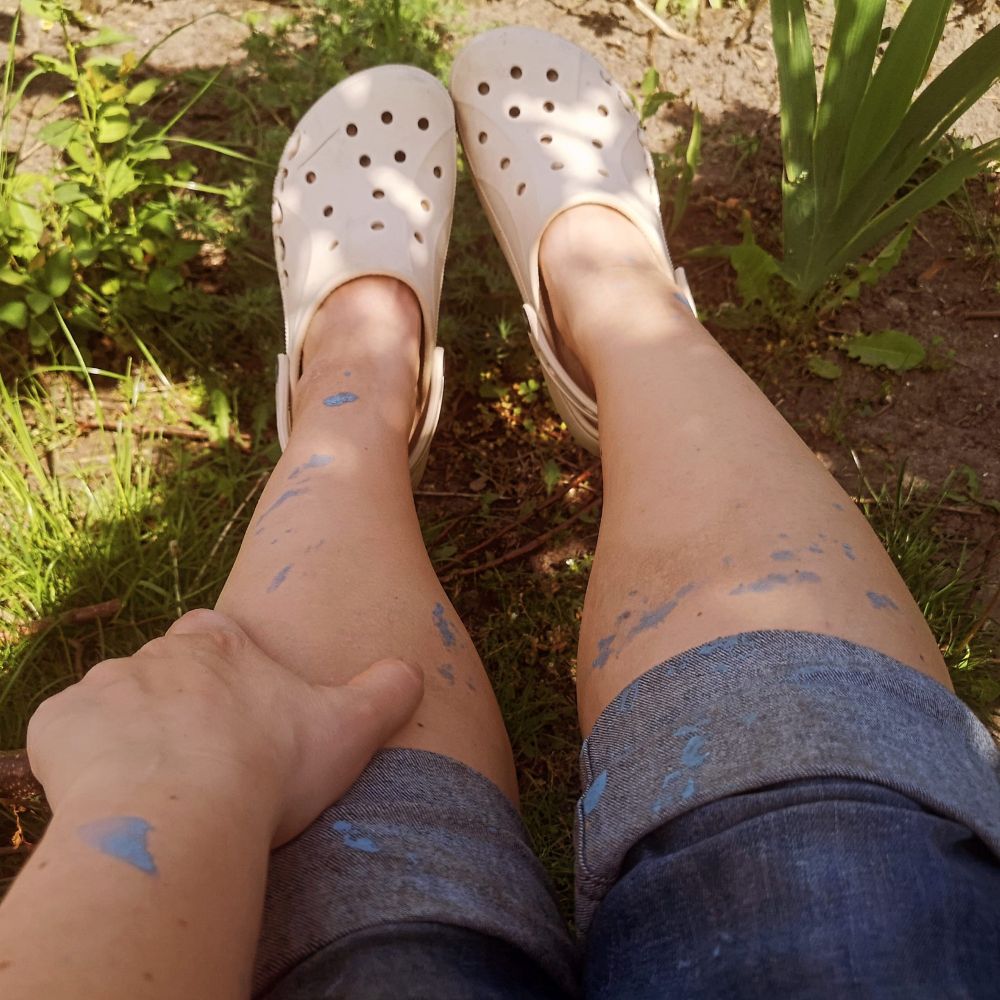 Blaue Farbe auf Arm und Beinen