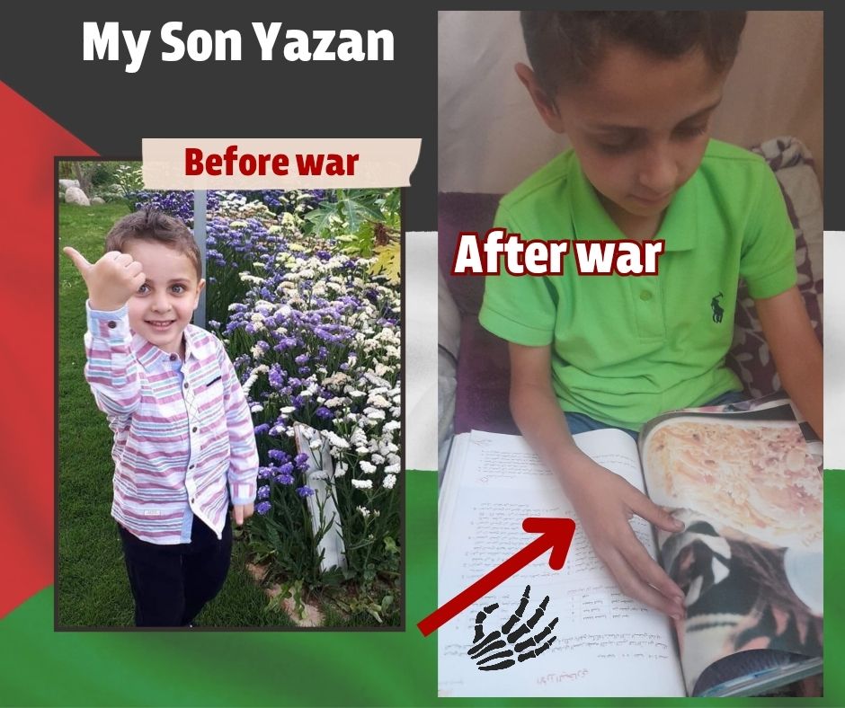 Alt text: A powerful comparison image of a young Palestinian boy named Yazan. On the left, labeled "Before war," Yazan is smiling brightly in a colorful shirt, standing confidently in front of vibrant flowers. On the right, labeled "After war," he appears much thinner, wearing a green shirt, looking down while studying. A red arrow points to his arm, now severely emaciated—just skin and bone—symbolizing the toll of war and hunger. A skeletal hand icon emphasizes the extreme weight loss. The background subtly includes the Palestinian flag colors.
